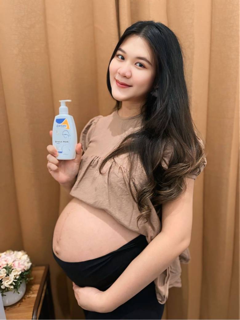 Hal yang Perlu Diperhatikan Saat Memilih Produk Cream Stretch mark Aman Bagi Ibu Hamil